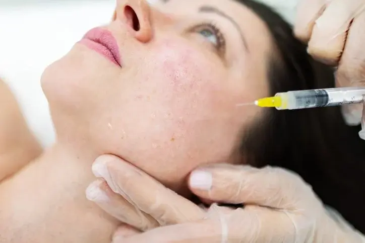 Dermal filler injection