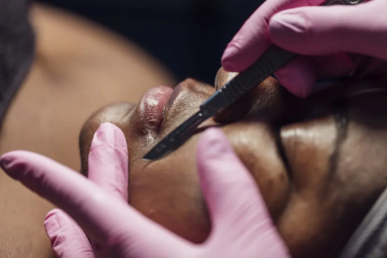 Cosmetic dermatology procedure