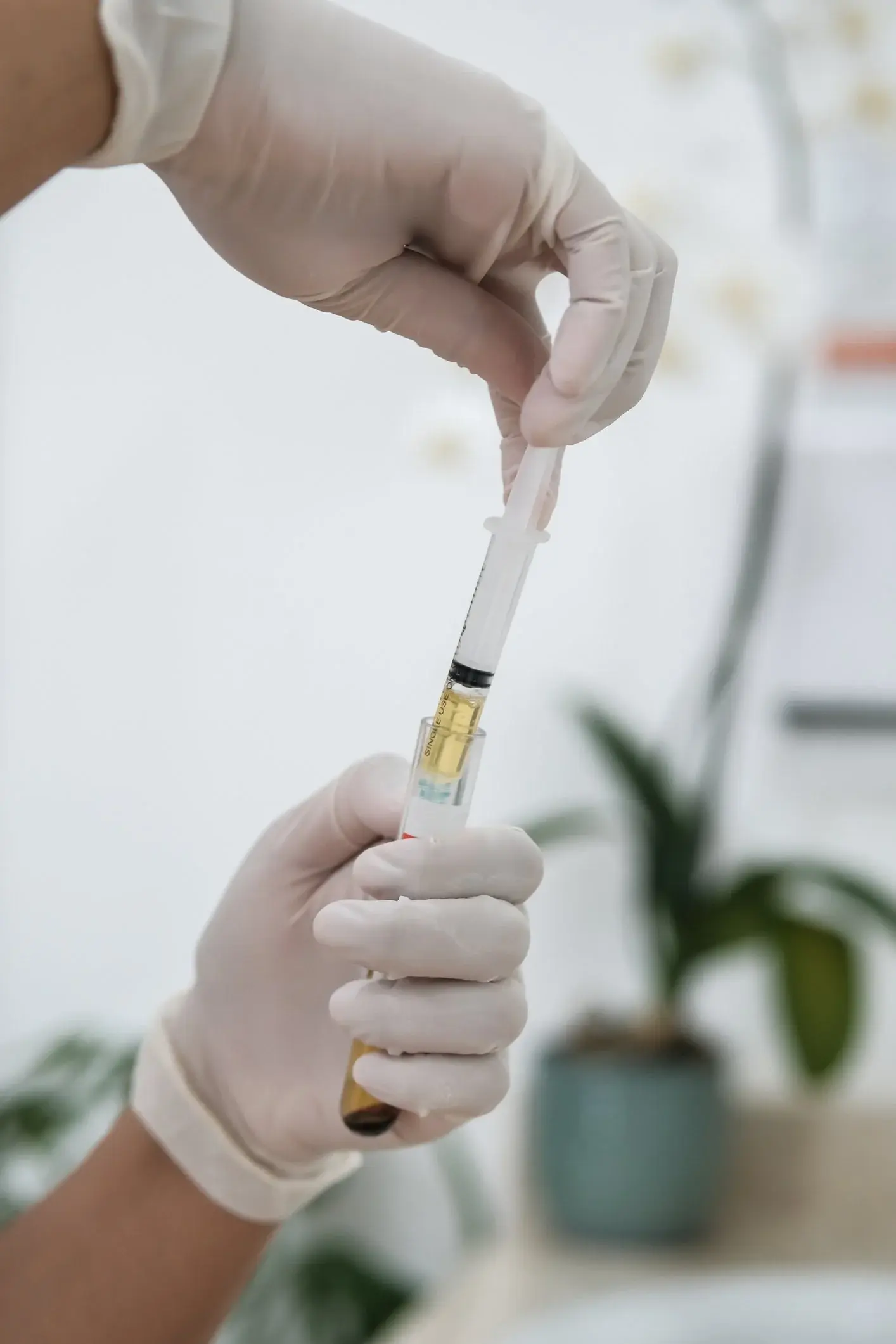 PRP facial treatment