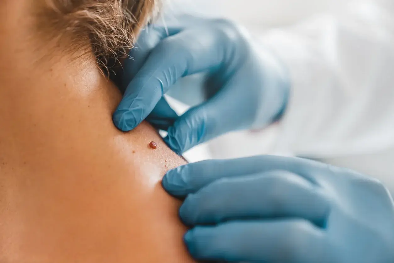 Medical dermatology examination