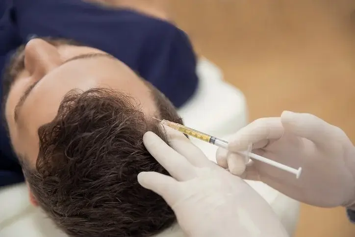 PRP hair treatment injection