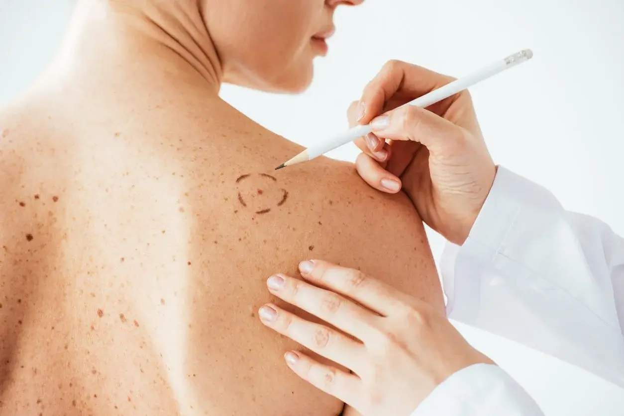 Skin growth examination